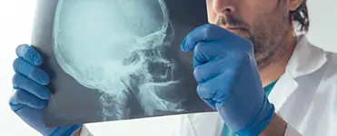 abogados de lesiones cerebrales traumáticas de california